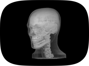 Tissue Simulation